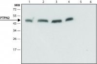 Anti-PTPN2 antibody produced in rabbit 