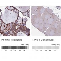 Anti-PTPN9 antibody produced in rabbit 