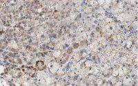 Anti-PTRH1 Antibody, clone 3O6 ZooMAb� Rabbit Monoclonal 