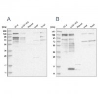 Anti-PUM1 antibody produced in rabbit 