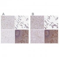 Anti-PYCARD antibody produced in rabbit HPA049074-100UL