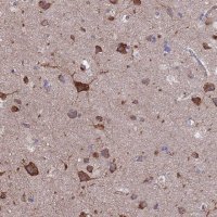 Anti-PYCR1 antibody produced in rabbit 