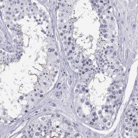 Anti-QRICH2 antibody produced in rabbit