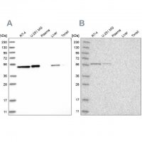 Anti-QRSL1 antibody produced in rabbit HPA029585-100UL