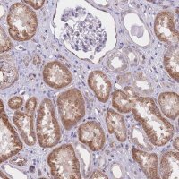 Anti-QTRT1 antibody produced in rabbit