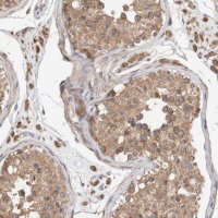 Anti-RAB14 antibody produced in rabbit HPA026419-100UL