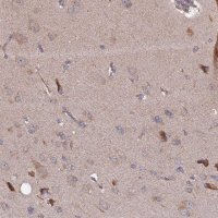 Anti-RAB15 antibody produced in rabbit