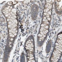 Anti-RAB21 antibody produced in rabbit 