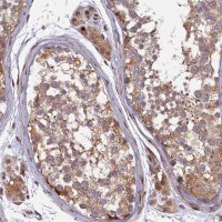 Anti-RAB28 antibody produced in rabbit HPA044575-100UL