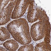 Anti-RAB39B antibody produced in rabbit HPA001114-100UL