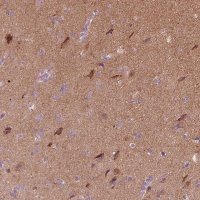 Anti-RAB3C antibody produced in rabbit