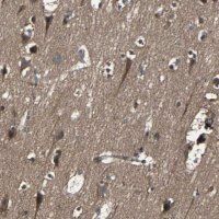 Anti-RAB7A antibody produced in rabbit