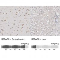 Anti-RABAC1 antibody produced in rabbit HPA029171-100UL