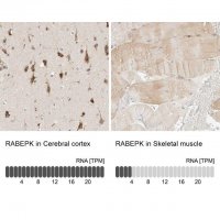 Anti-RABEPK antibody produced in rabbit