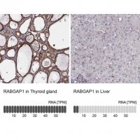 Anti-RABGAP1 antibody produced in rabbit 