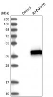 Anti-RABGGTB antibody produced in rabbit 