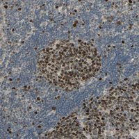 Anti-RAD18 antibody produced in rabbit