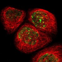 Anti-RAD18 antibody produced in rabbit