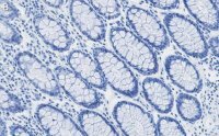 Anti-RAD21 Antibody, clone 2H12 ZooMAb® Rabbit Monoclonal