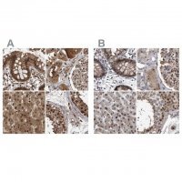 Anti-RAD23B antibody produced in rabbit 