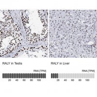 Anti-RALY antibody produced in rabbit HPA040971-100UL