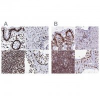 Anti-RALY antibody produced in rabbit HPA040971-100UL