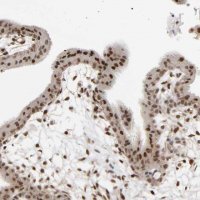 Anti-RARB antibody produced in rabbit