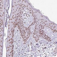Anti-RARG antibody produced in rabbit 