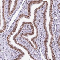 Anti-RARG antibody produced in rabbit 