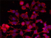 Anti-RASD2 antibody produced in rabbit SAB4200432-200UL