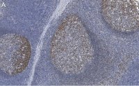 Anti-Rb Antibody, clone 2M15 ZooMAb� Rabbit Monoclonal 