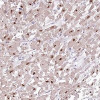 Anti-RBM20 antibody produced in rabbit 