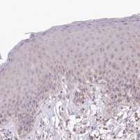 Anti-RBM20 antibody produced in rabbit 