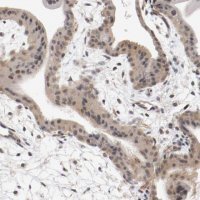 Anti-RBM23 antibody produced in rabbit 