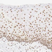 Anti-RBM39 antibody produced in rabbit HPA001591-100UL