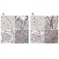 Anti-RBM6 antibody produced in rabbit 