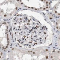 Anti-RBM6 antibody produced in rabbit 