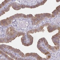 Anti-RBP1 antibody produced in rabbit HPA007338-100UL