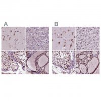 Anti-RCOR3 antibody produced in rabbit 