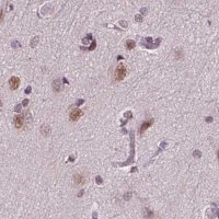 Anti-RCOR3 antibody produced in rabbit 