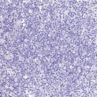 Anti-RDH16 antibody produced in rabbit HPA038518-100UL