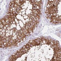 Anti-REEP1 antibody produced in rabbit