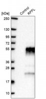 Anti-RFFL antibody produced in rabbit HPA019492-100UL