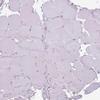 Anti-RFX2 antibody produced in rabbit 