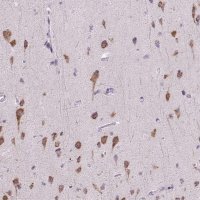Anti-RHBDD2 antibody produced in rabbit HPA051960-100UL