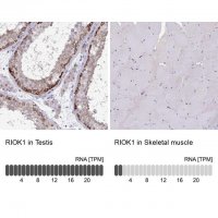 Anti-RIOK1 antibody produced in rabbit 
