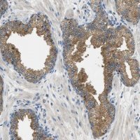 Anti-RIPK2 antibody produced in rabbit 