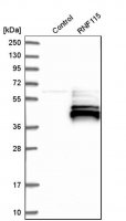 Anti-RNF115 antibody produced in rabbit 