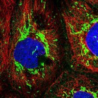 Anti-RNF138 antibody produced in rabbit 