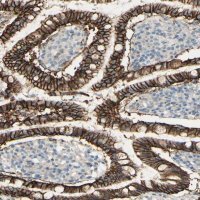 Anti-RNF149 antibody produced in rabbit 